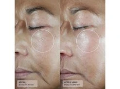 Senté Dermal Repair Ultra-Nourish -Beauty Shop 1fl3h30r 202305051530253544