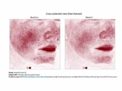 Senté Dermal Repair Ultra-Nourish -Beauty Shop c0uq52ch 202102171808210964