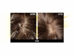 Hairsanity Anti-Dandruff Conditioner 13 Hairsanity Anti-Dandruff Conditioner -Beauty Shop l4fzdxzg 202109222048528925