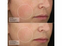 Senté Dermal Repair Ultra-Nourish -Beauty Shop ppqh0vme 202305051532237433