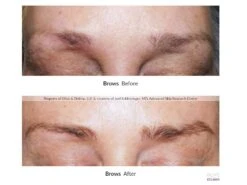 NeuBROW PROFESSIONAL™ Brow Enhancing Serum By Skin Research Laboratories® -Beauty Shop ufrx4kac 202004082228295331